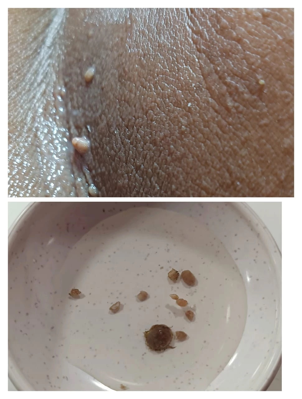 FACIAL SKINTAGS PROMOTION